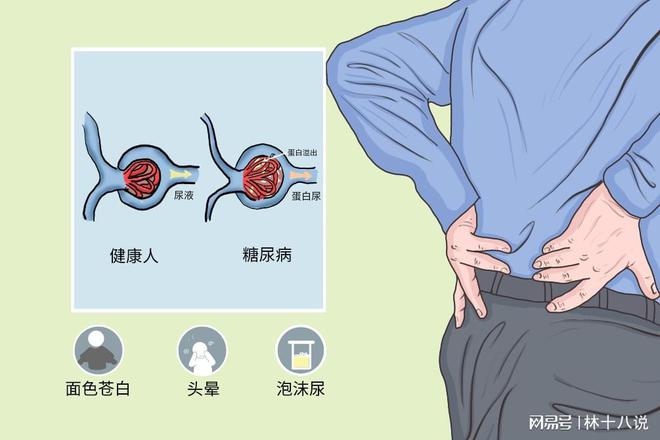 素材取自网络