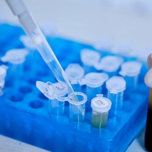 贝瑞基因试剂盒通过医疗器械注册检验，助力出生缺陷预防